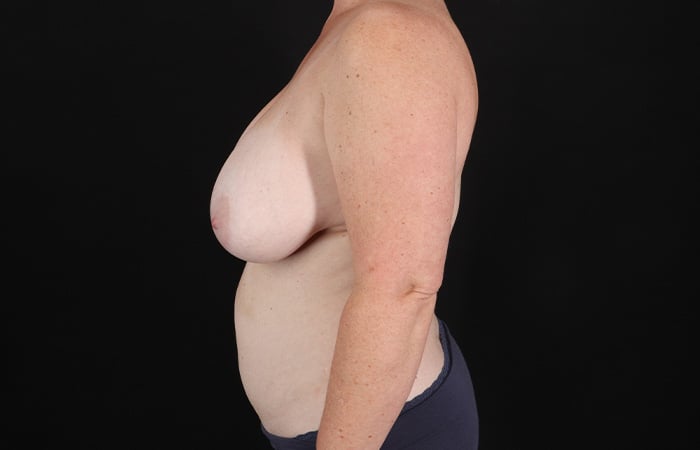 case-36921-left-lateral-before