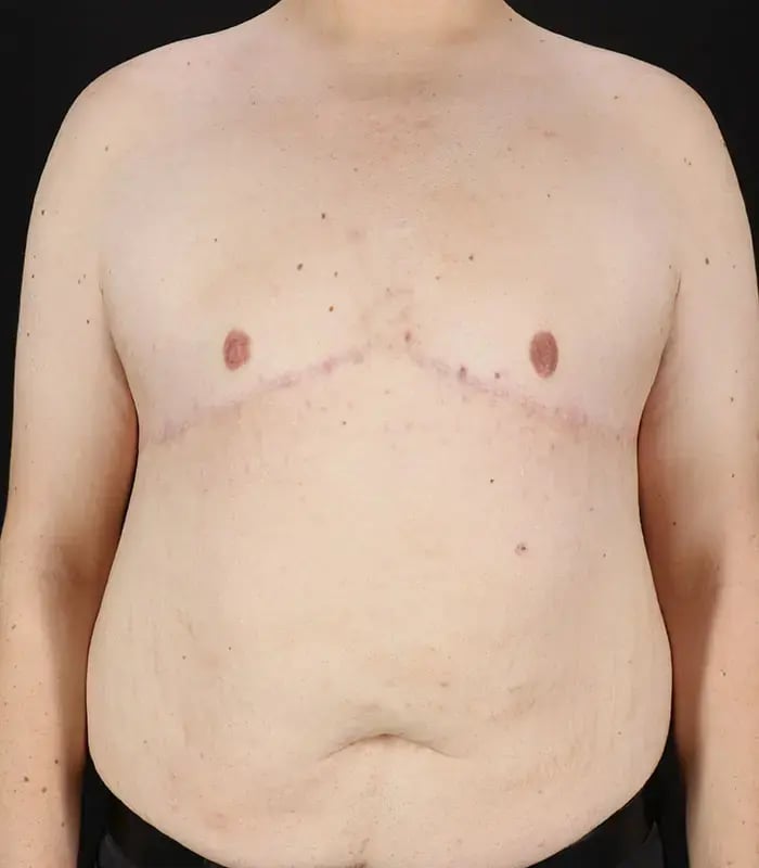 male 1 after