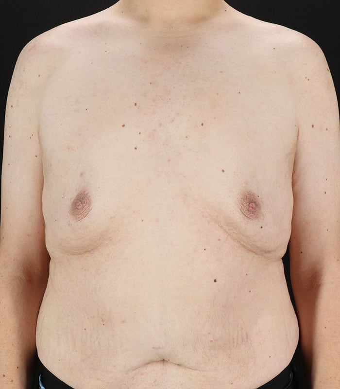 male 1 before