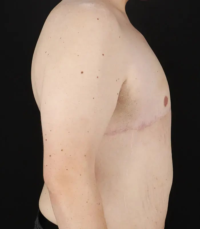male 3 after