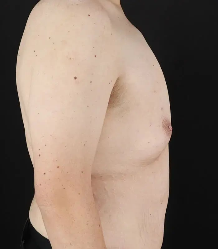 male 3 before