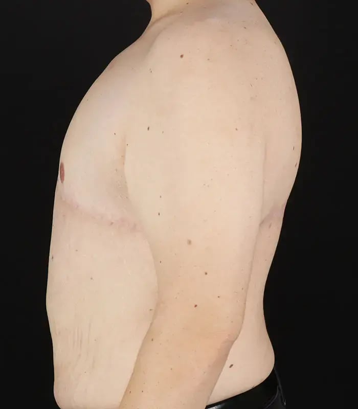 male 5 after