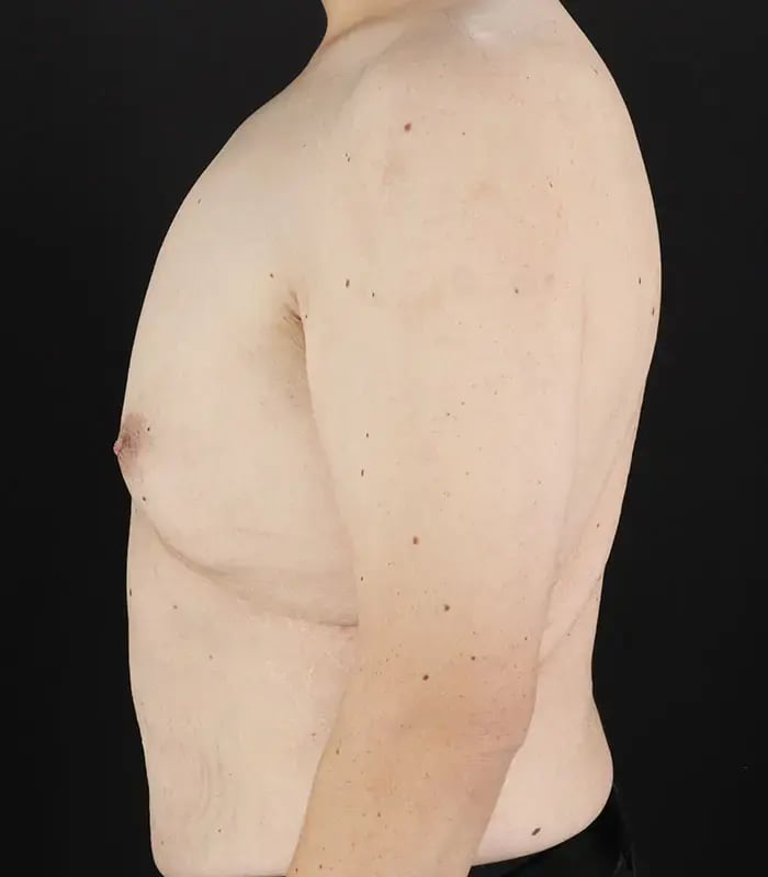 male 5 before