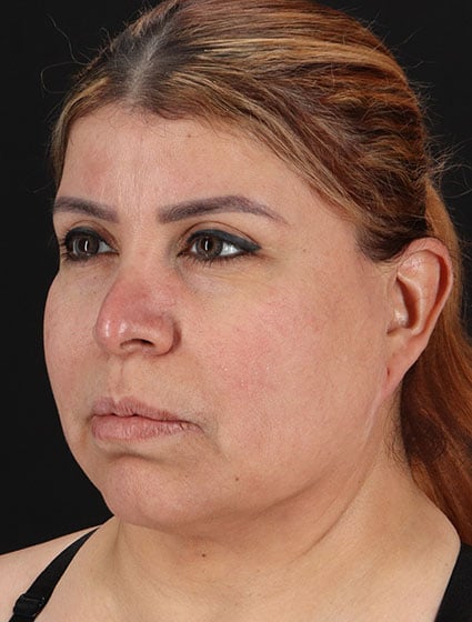 original - 2025-03-11T092529.590