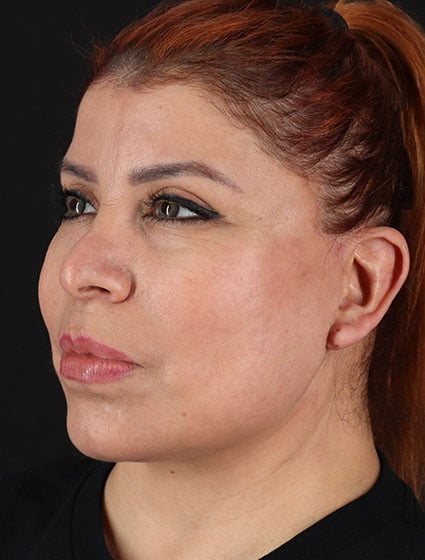 original - 2025-03-11T092532.517