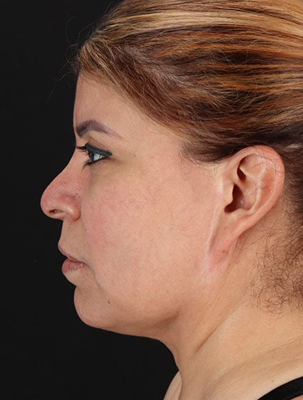 original - 2025-03-11T092536.165