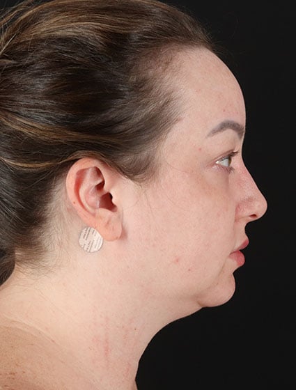 original - 2025-03-11T092556.419