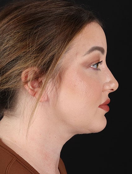 original - 2025-03-11T092559.414