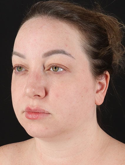 original - 2025-03-11T092603.809