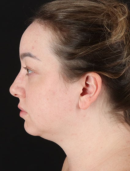 original - 2025-03-11T092611.064