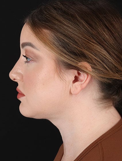 original - 2025-03-11T092614.159