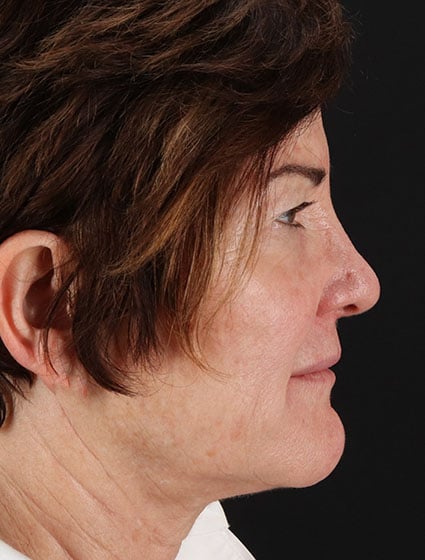 original - 2025-03-11T092634.142