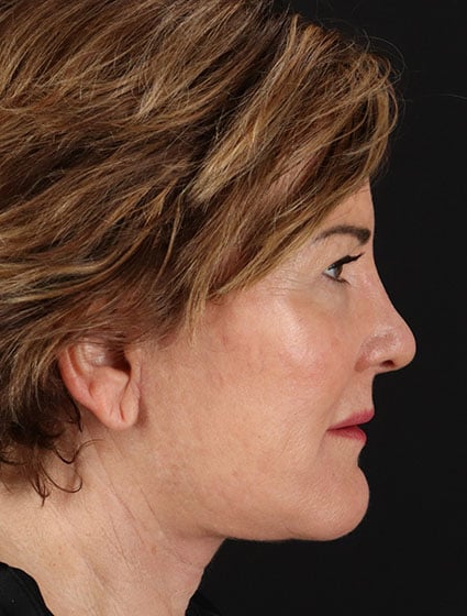 original - 2025-03-11T092636.969