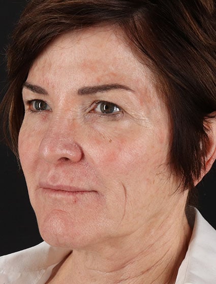 original - 2025-03-11T092640.589