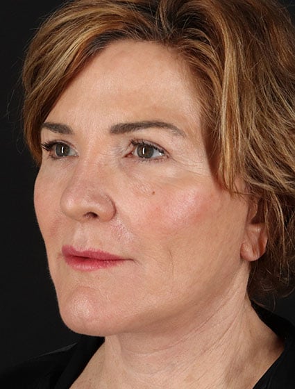 original - 2025-03-11T092643.789