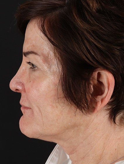 original - 2025-03-11T092647.311