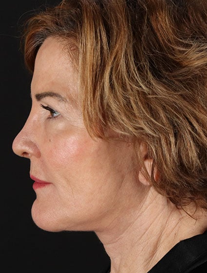 original - 2025-03-11T092650.564